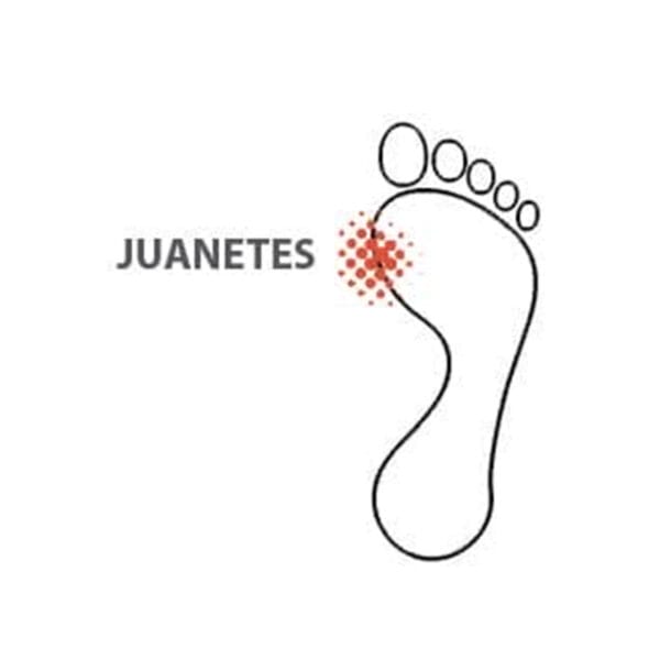 SMOU HALLUX Plantillas para juanete rígido | Limitan el movimiento del primer metatarso, aliviando el dolor de juanete | Plantillas ortopédicas mujer o hombre - Imagen 2